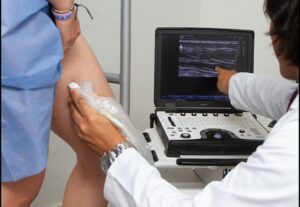 Lee más sobre el artículo Doppler Venoso de Miembros Inferiores