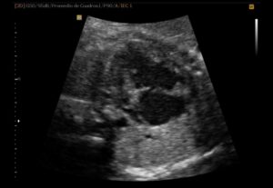 Lee más sobre el artículo Cardiopatías Congénitas Fetales